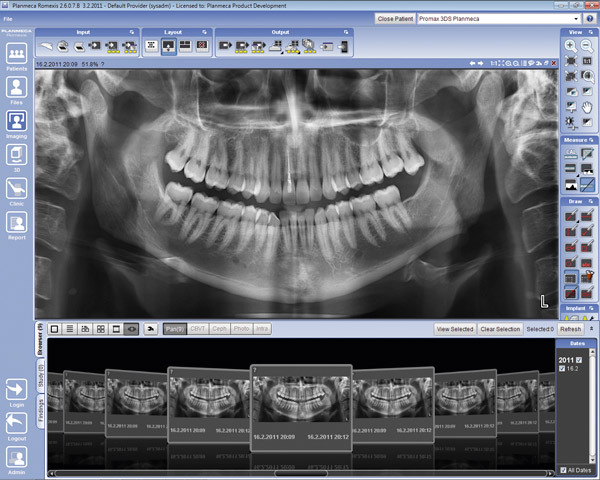 3D 電腦斷層